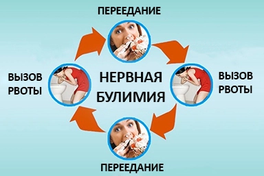 Лечение булимии в Малой Пурге